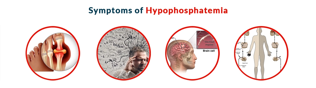 Symptoms of Hypophosphatemia